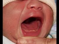 Newborn coughs and sneezes, no temperature - reasons